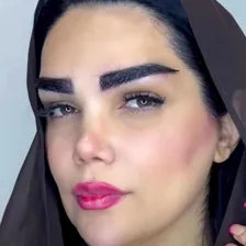 کلینیک پوست مو زیبایی و لیزر آسو