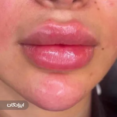 کلینیک زیبایی مایا