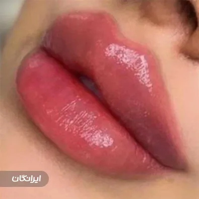 کلینیک زیبایی مایا