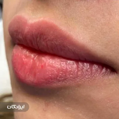 کلینیک زیبایی مایا