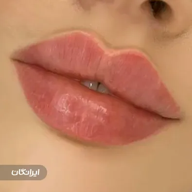 کلینیک زیبایی ژیوانو