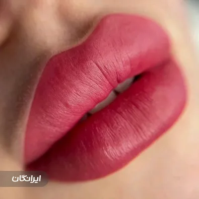 کلینیک زیبایی ژیوانو