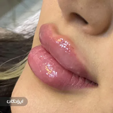 کلینیک زیبایی لاویش