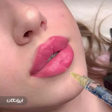 کلینیک زیبایی هانا