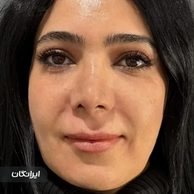 کلینیک زیبایی هانا