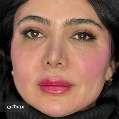 کلینیک زیبایی هانا