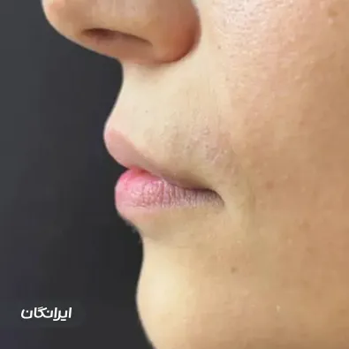 کلینیک زیبایی رایا