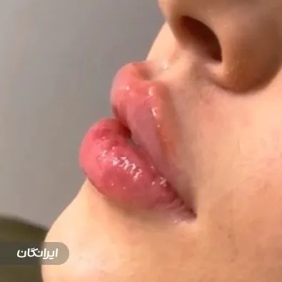 کلینیک زیبایی رایا