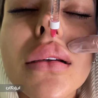 کلینیک زیبایی دکتر اصغر حسینی