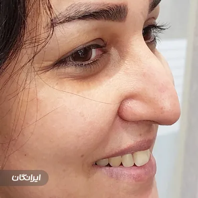 مرکز فیشیال نیک اسکین