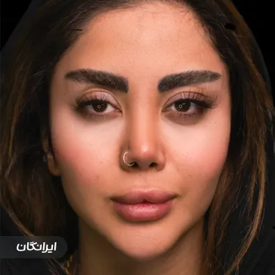 کلینیک زیبایی ستایش