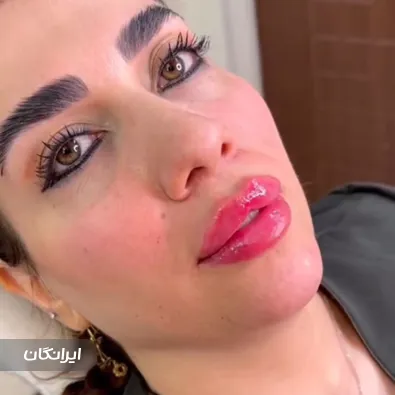 کلینیک زیبایی شایلی