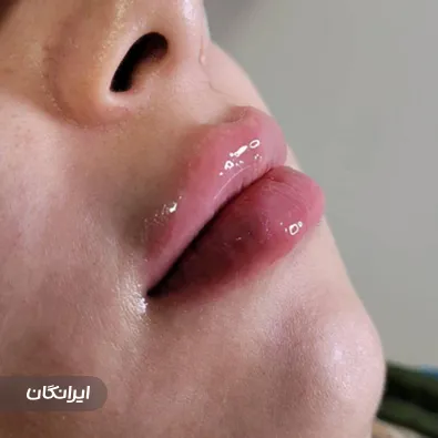 کلینیک زیبایی یاسمینا