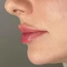 کلینیک زیبایی دکتر مریم شهسواری