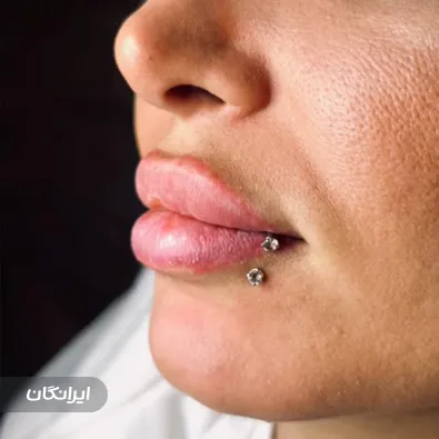 کلینیک زیبایی نابلکس