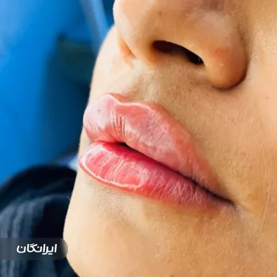 کلینیک زیبایی نابلکس