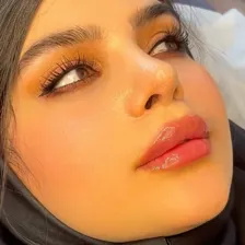 کلینیک زیبایی نابلکس