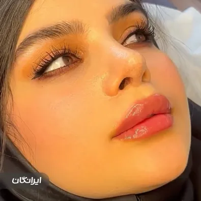 کلینیک زیبایی نابلکس