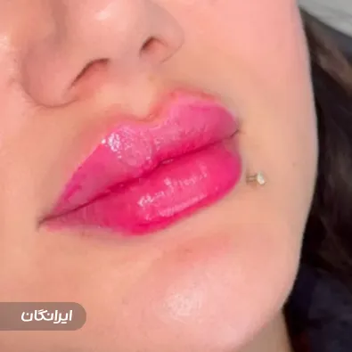 کلینیک زیبایی نهال