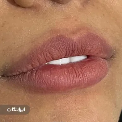 کلینیک زیبایی دکتر میثم رمضانپور خاکی