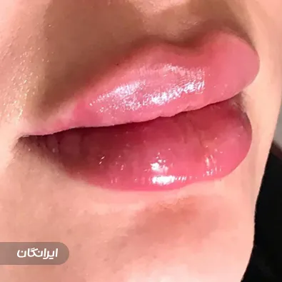 کلینیک زیبایی دکتر میثم رمضانپور خاکی