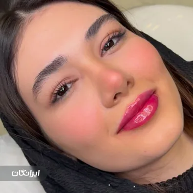 کلینیک زیبایی وینا