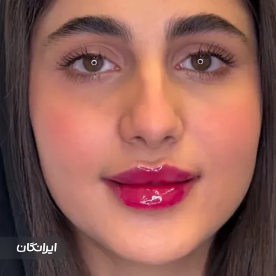 کلینیک زیبایی وینا