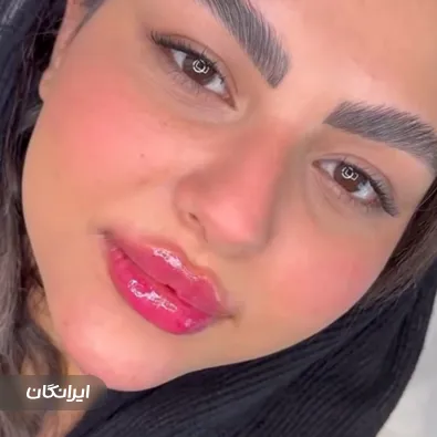 کلینیک زیبایی وینا