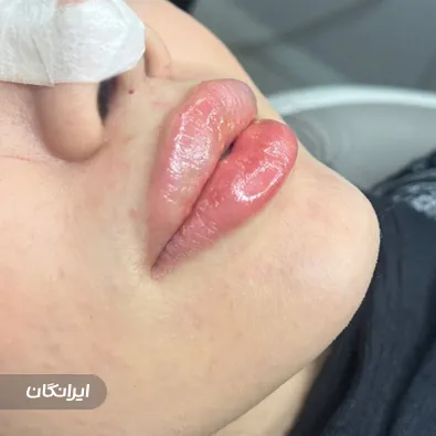 کلینیک زیبایی لاوین