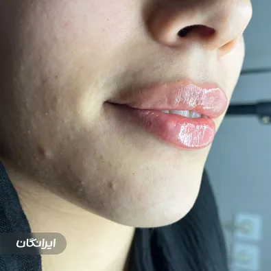 کلینیک زیبایی لاوین