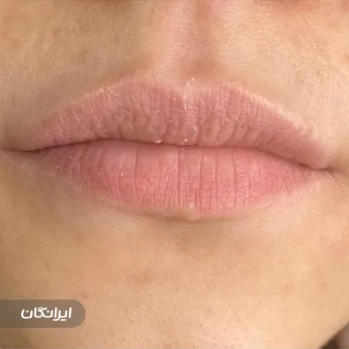 کلینیک زیبایی بهار