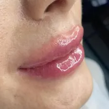 کلینیک زیبایی بهار