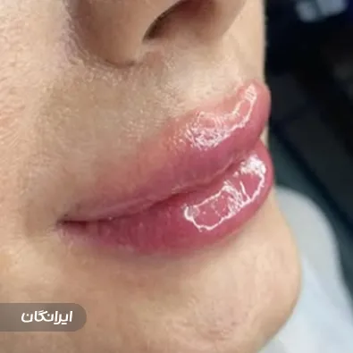 کلینیک زیبایی بهار