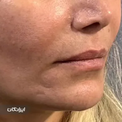 کلینیک زیبایی دکتر سارینا دیباوری