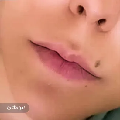 کلینیک زیبایی بیوتی آفیس