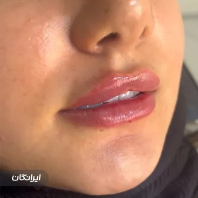 کلینیک زیبایی بیوتی آفیس