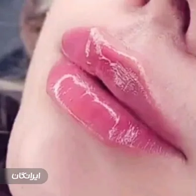 کلینیک زیبایی بیوتی آفیس