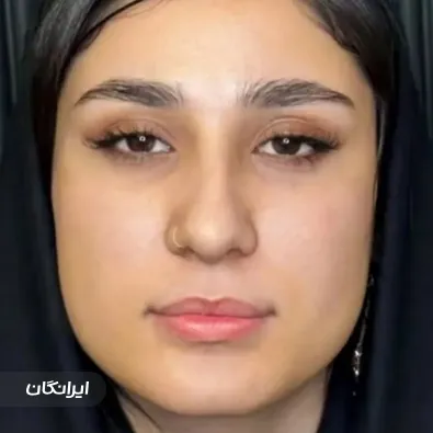 کلینیک زیبایی پرنسس