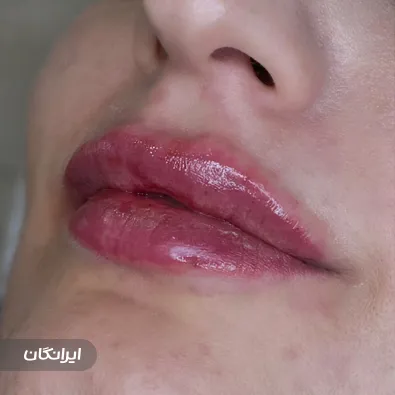 کلینیک زیبایی پرنسس