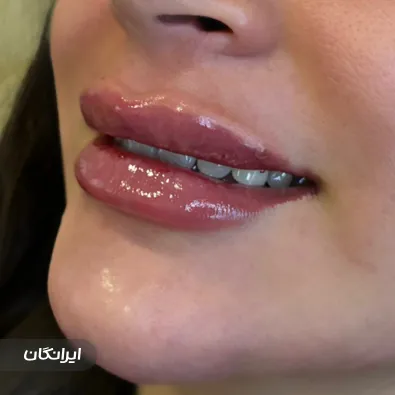 کلینیک زیبایی پرنسس