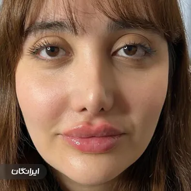 کلینیک زیبایی سلین