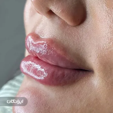 کلینیک زیبایی سلین