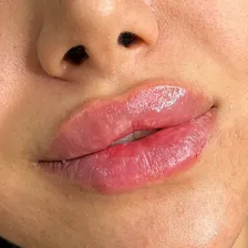 کلینیک زیبایی بنفشه