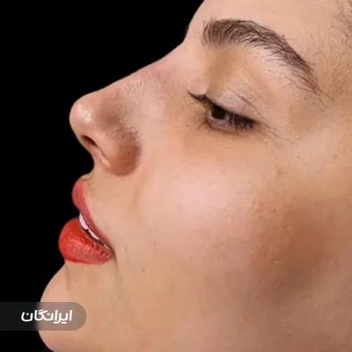 کلینیک زیبایی دکتر بهزاد میرزایی