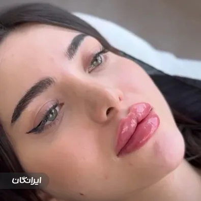 کلینیک زیبایی دکتر بهزاد میرزایی