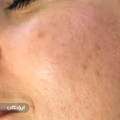 سالن پاکسازی پوست و فشیال مستانه