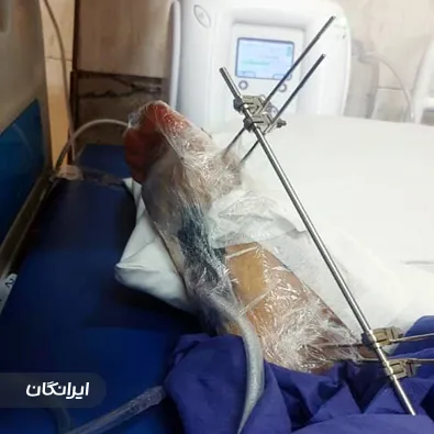 کلینیک درمان زخم آرزو طاهرالدینی