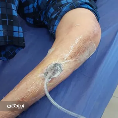 کلینیک درمان زخم آرزو طاهرالدینی