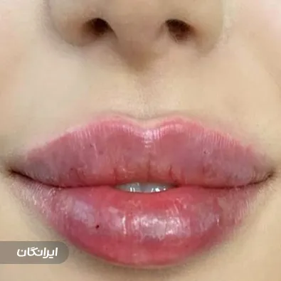 کلینیک مراقبت پوست مو زیبایی الیزه سرخ