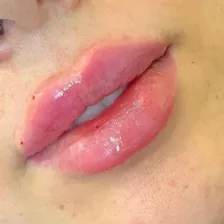 کلینیک مراقبت پوست مو زیبایی الیزه سرخ